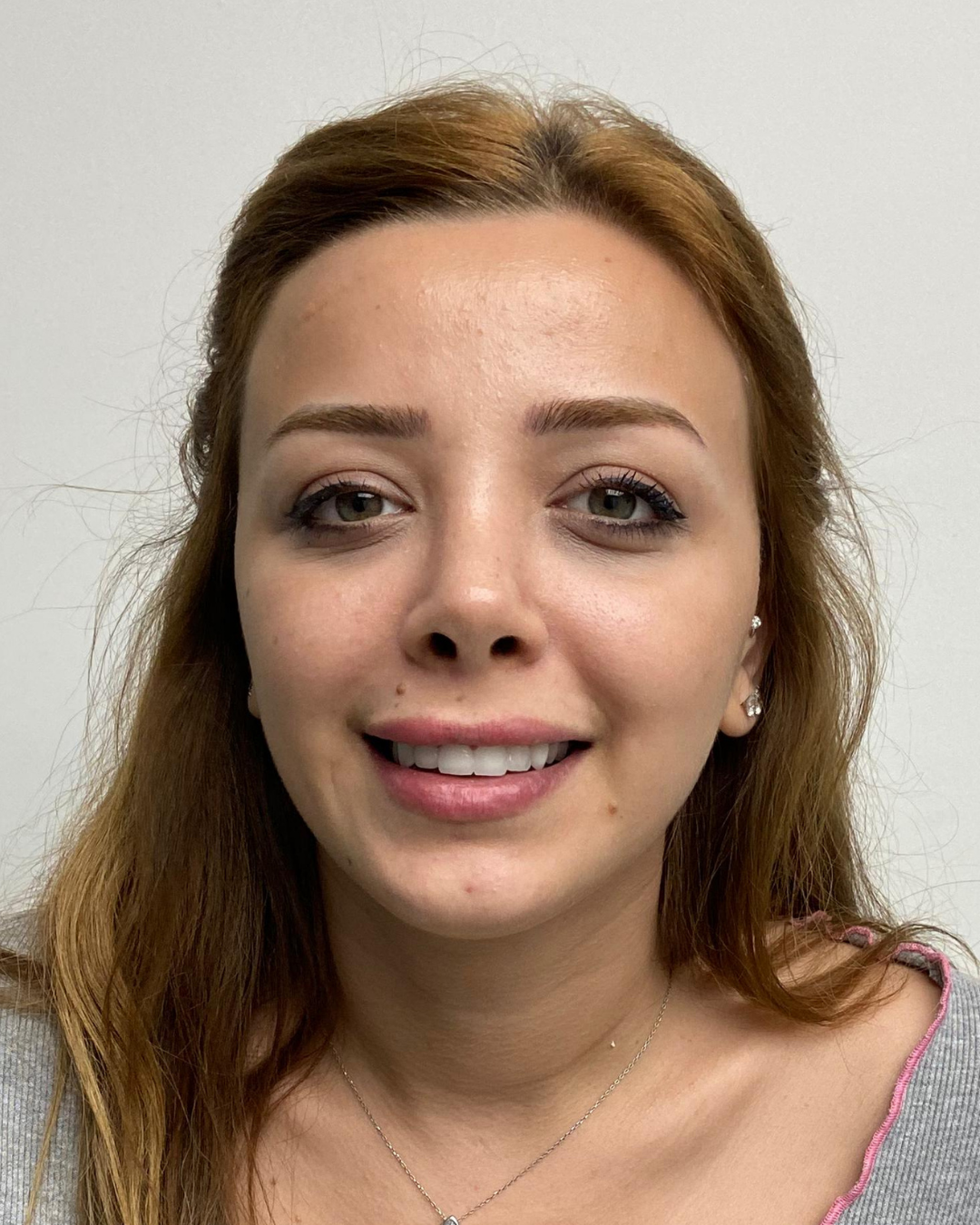Sonrası